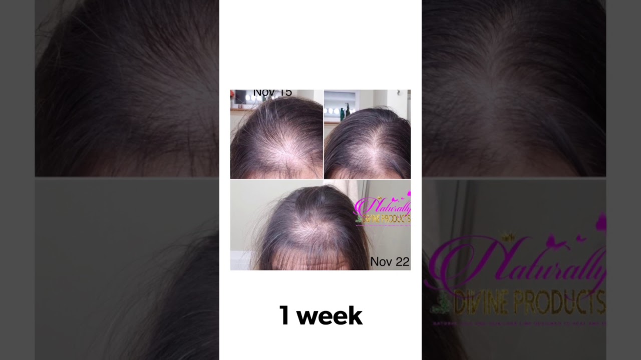 Extreme Regrowth Elixir by Naturally Divine Products