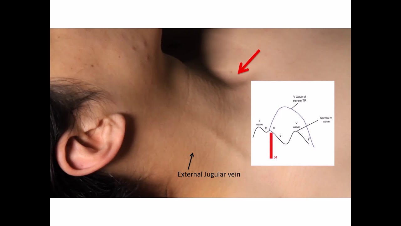 Neck veins examination  | part 3 cardiovascular examination | cardiology | 5th grade