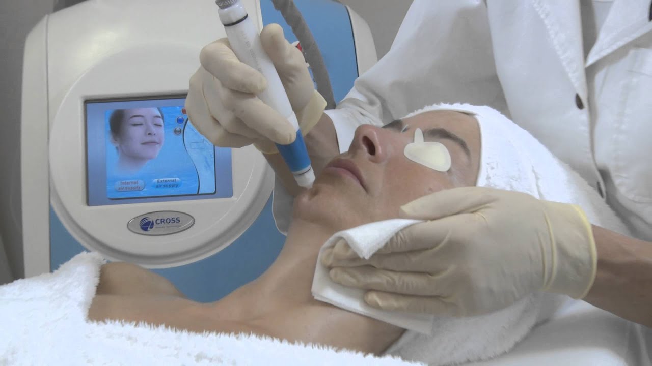 Jet Peel Anti-Age Treatment BIODROGA MD