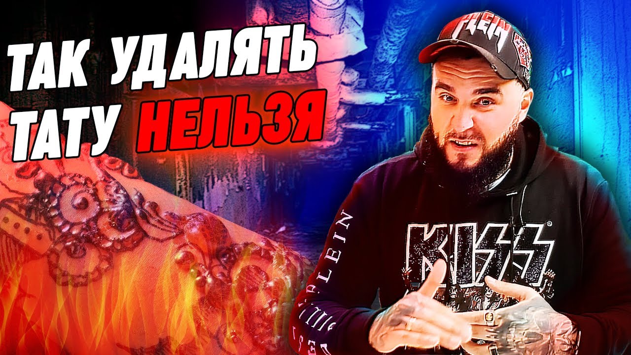 Удаление татуировки лазером – вся правда! / Как разводят людей на удалении тату?