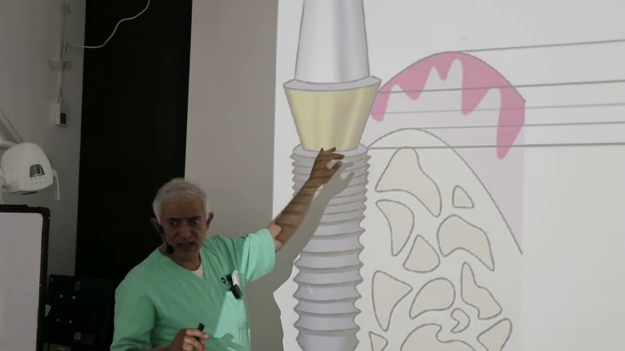Thomas' theory of zero bone loss &restoration quality control, concave cervical abutment connection