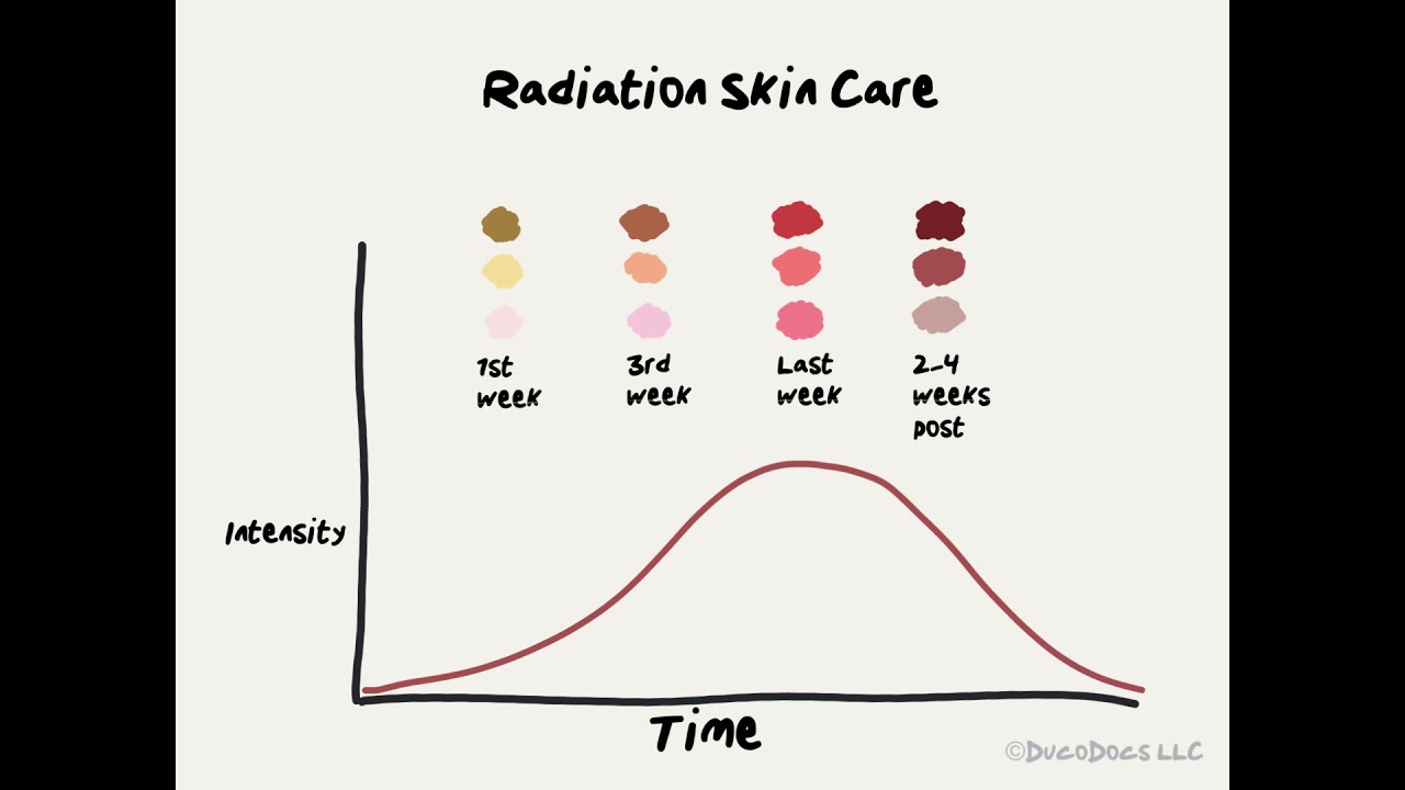 Doctor Explains Radiation Skin Care and Tips