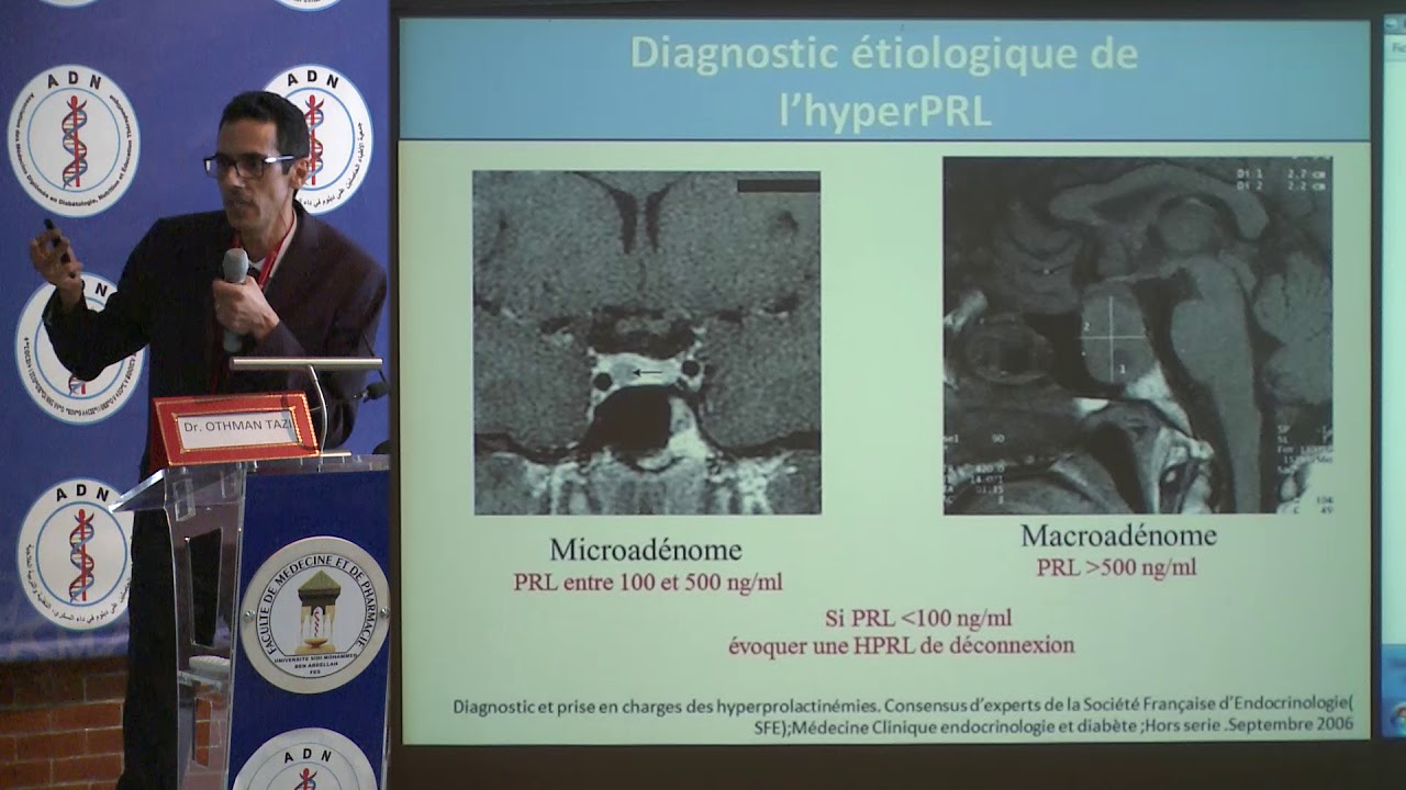 ADN 2017 - L'hyperprolactinémie diagnostic au traitement - Dr Othman TAZI 2