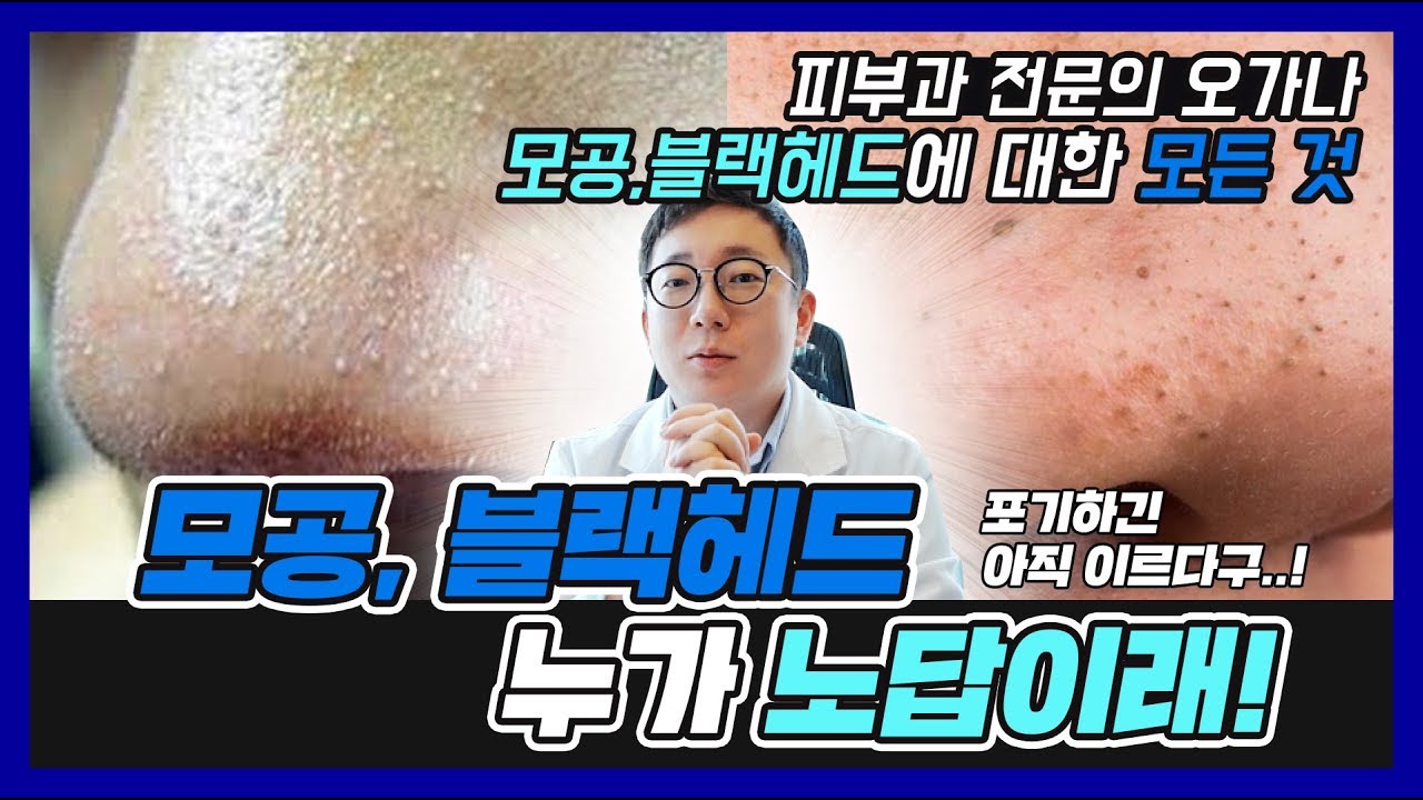 모공, 블랙헤드. 누가 노답이래!? 