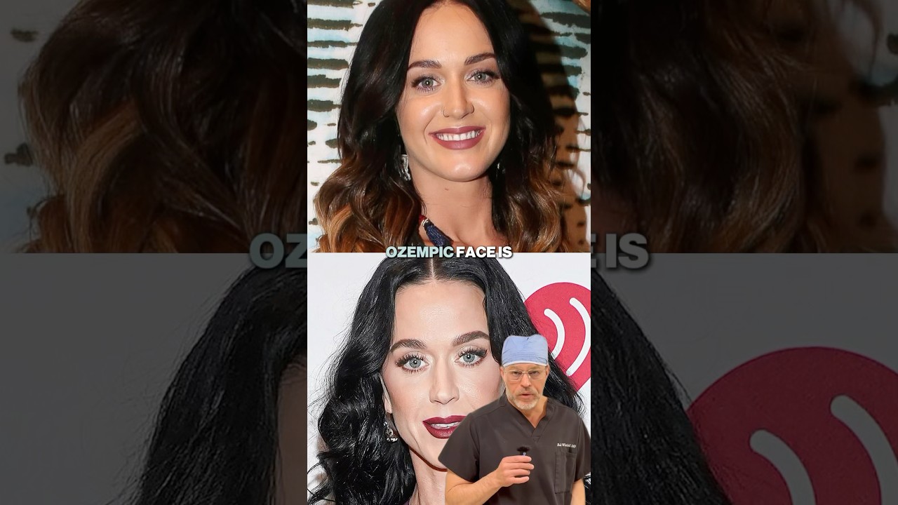The Truth About Ozempic Face | What Really Causes Facial Aging #ozempic #ozempicface