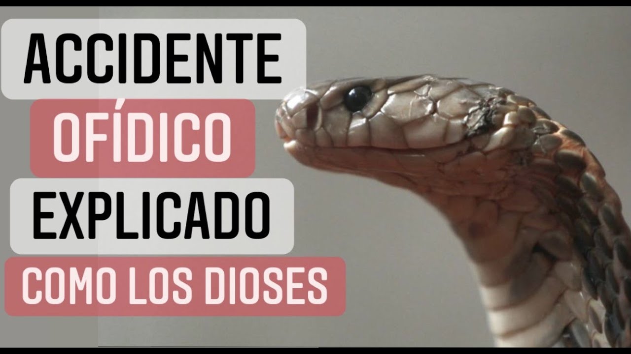 Que HACER ante un ATAQUE por SERPIENTE? ✅