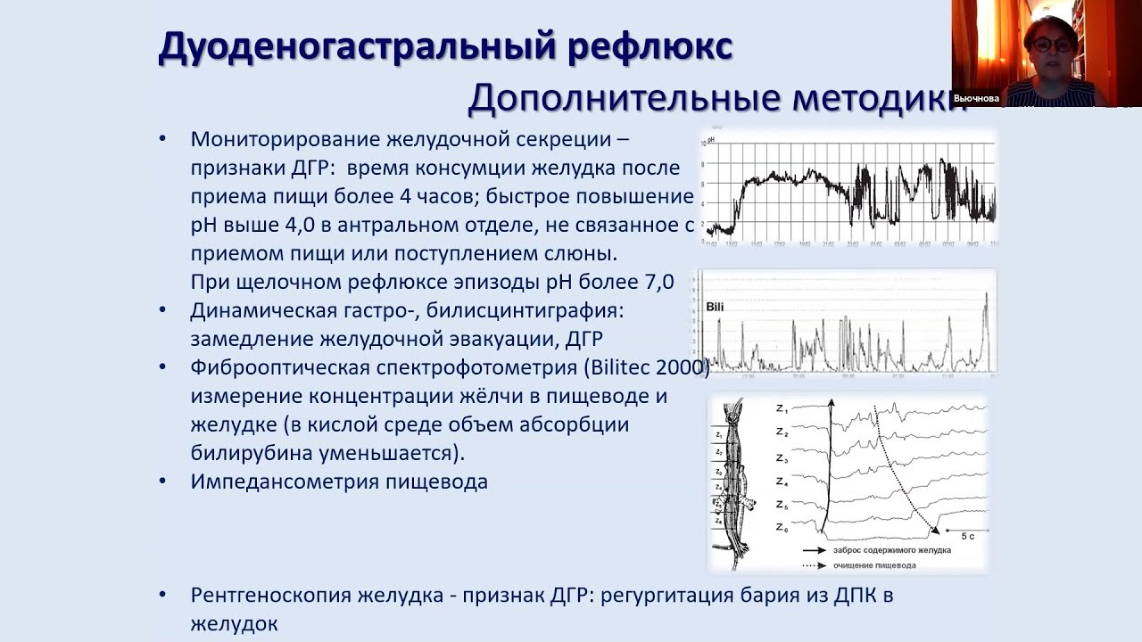 Вьючнова Е.С. Тактика ведения пациентов с дуоденогастральным/билиарным рефлюксом