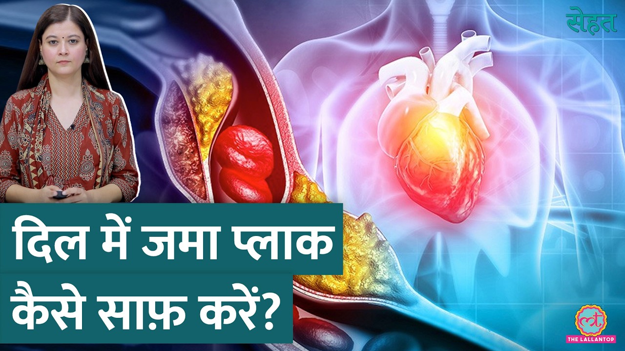 दिल में क्यों होता है Plaque Buildup जिससे पड़ता है Heart Attack, जानिए कैसे बचें? | Sehat ep 981