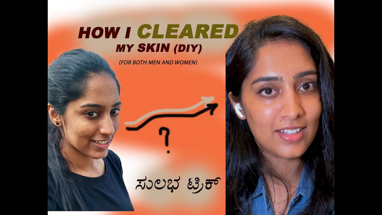 I did these 5 steps to get glowing and clear skin | Skincare routine | Kannada Vlogs
