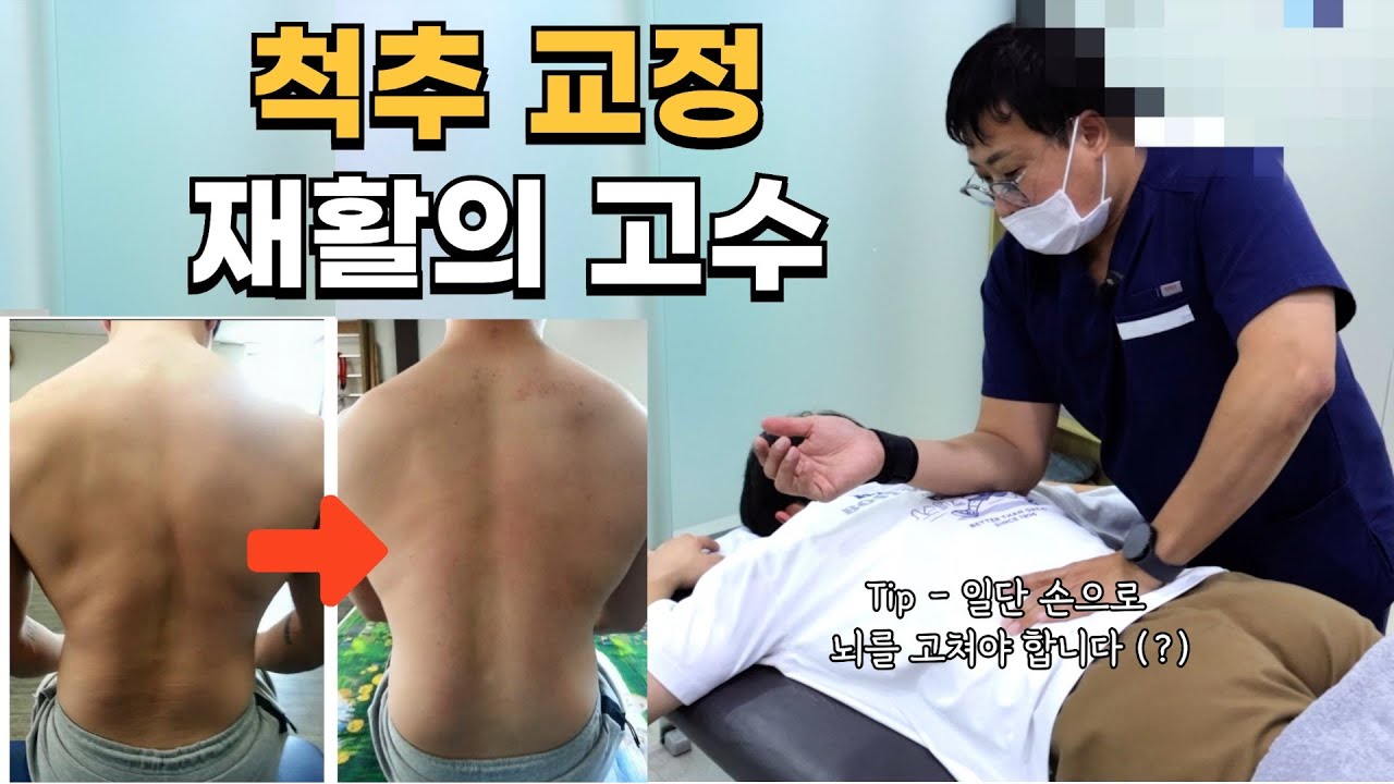 척추를 다림질 하듯이 펴버리는 척추 교정 재활의 고수