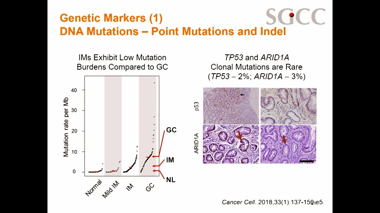 Novel Molecular Risk Stratification Tools in Intestinal Metaplasia: The Singaporean Experience