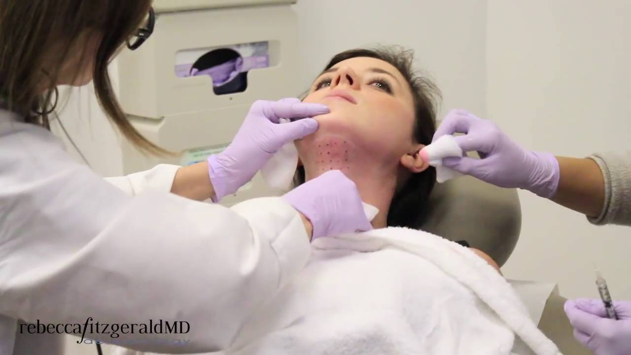 Treat Double Chin with Kybella Injections - Dr. Fitzgerald