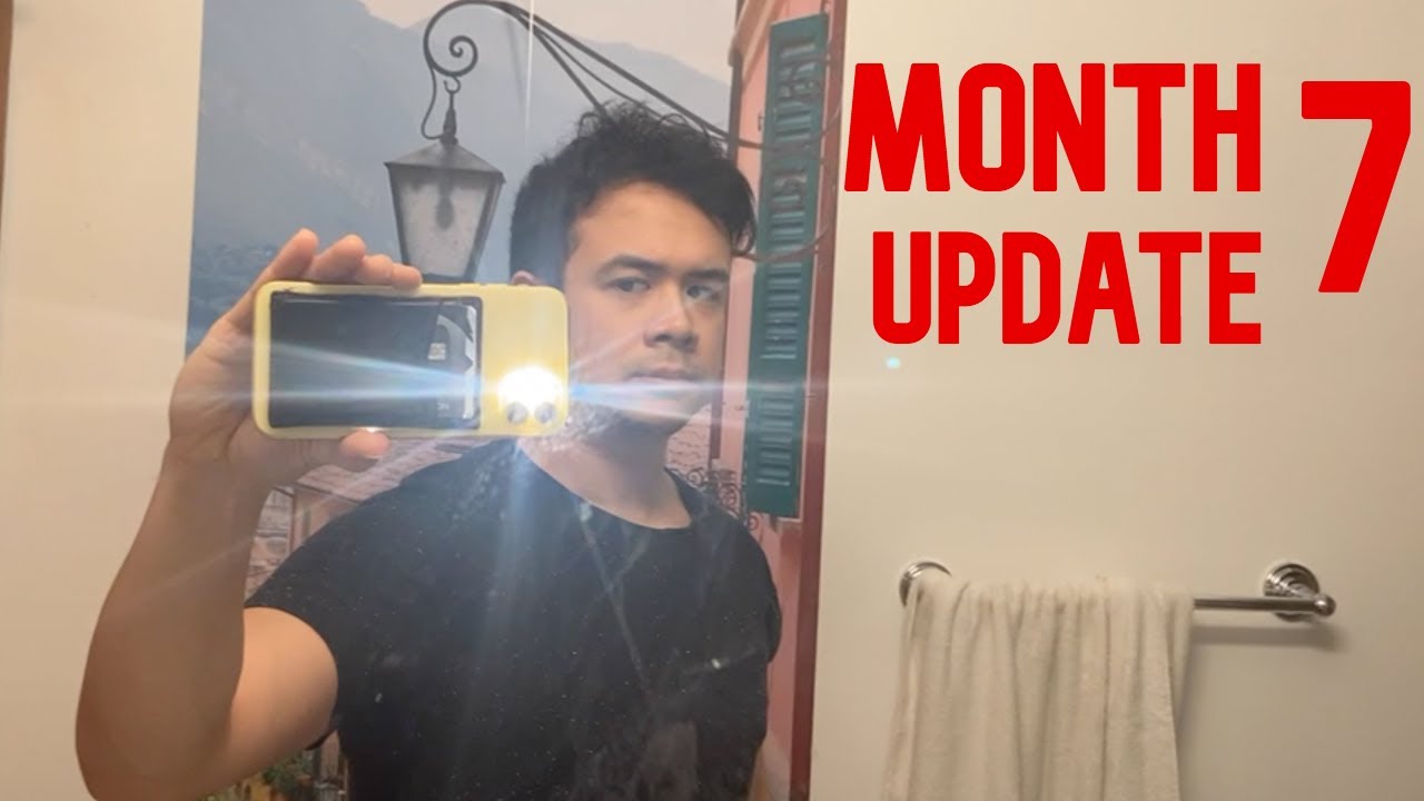 7 Months After My Second FUE Hair Transplant in Istanbul, Turkey | Dr. Cinik Clinic