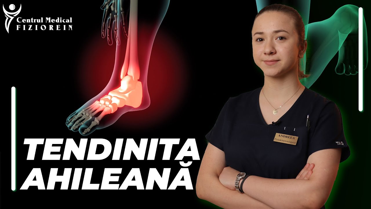 Tendinita ahileană- Centrul Medical Fiziorein
