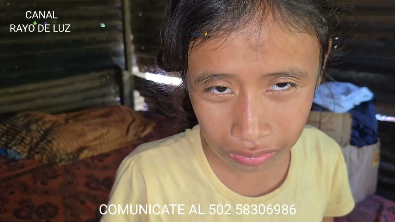 Nació así 😞; pero aún así lucha para comprar sus medicinas. Aquí todos son especiales. Apoyo llegó🙏
