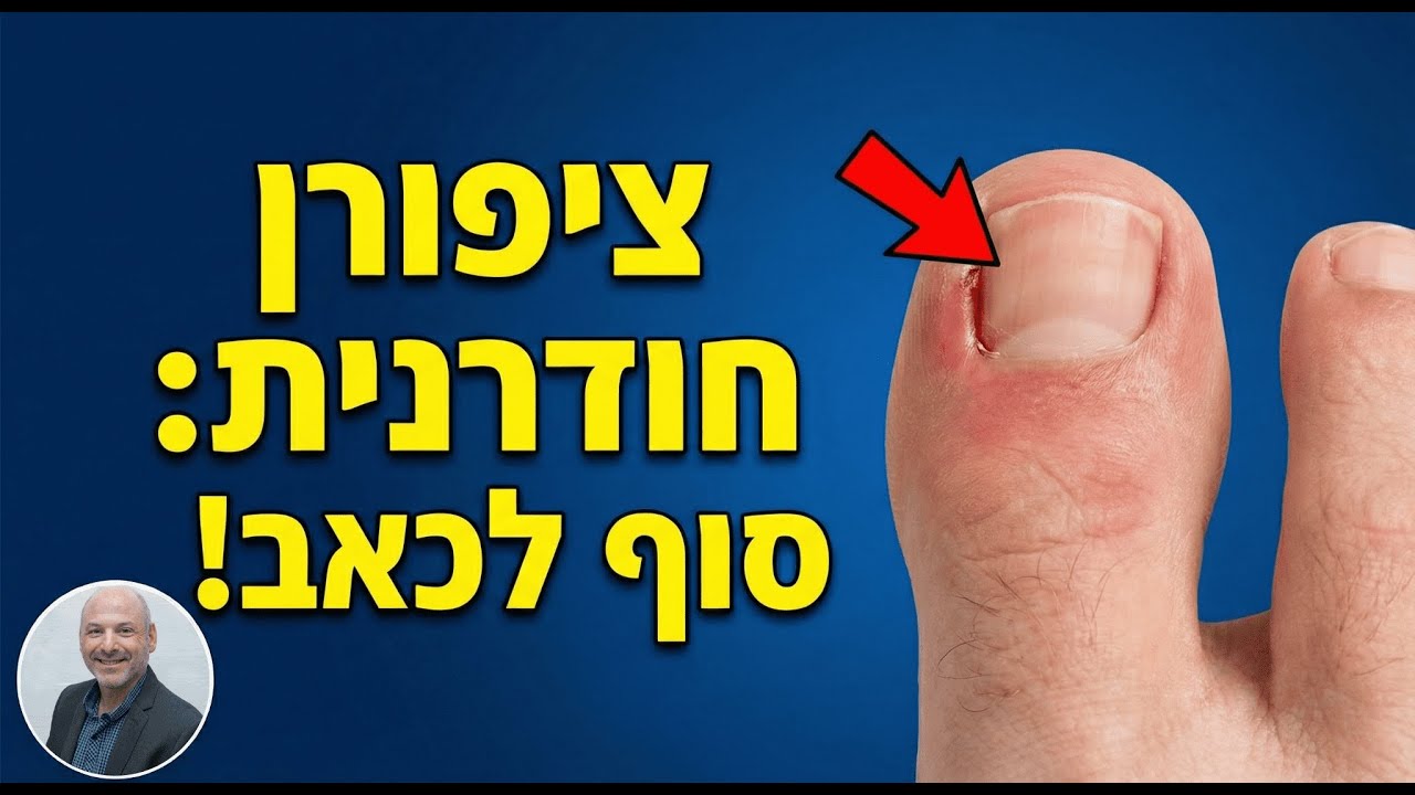 ציפורן חודרנית: איך להיפטר מהכאב לתמיד? (בלי שזה יחזור)
