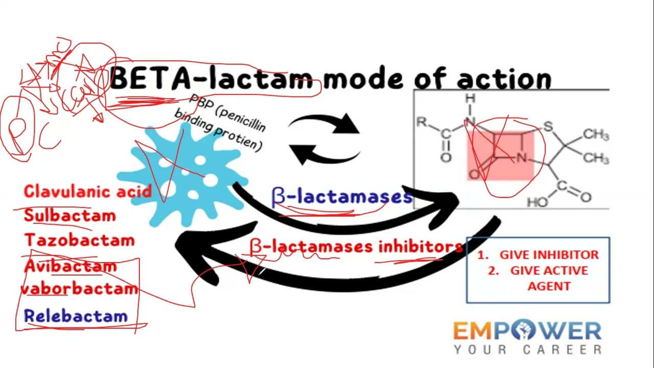 Treatment of resistance (ESBLs) according to the IDSA 2022