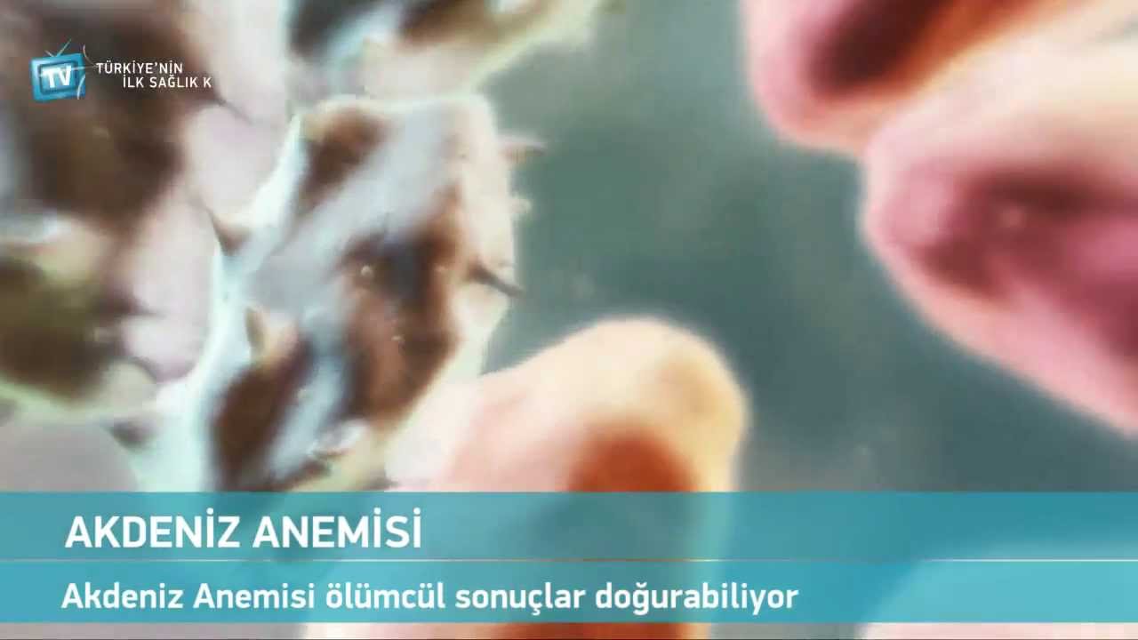 Akdeniz Anemisi nedir?
