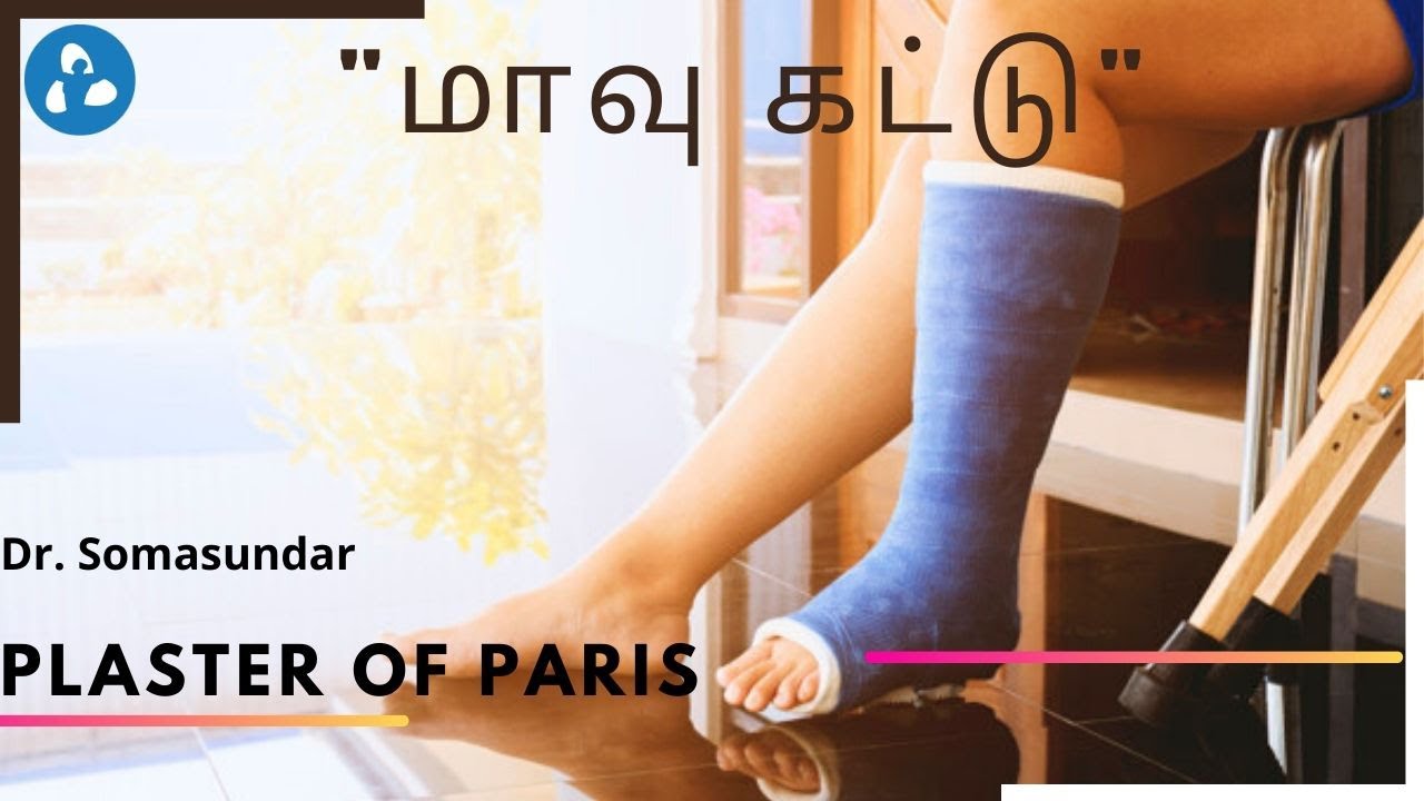 மாவு கட்டு பற்றி கூறுகிறார்  (Cast with Plaster of Paris) | Patient Education | MIC