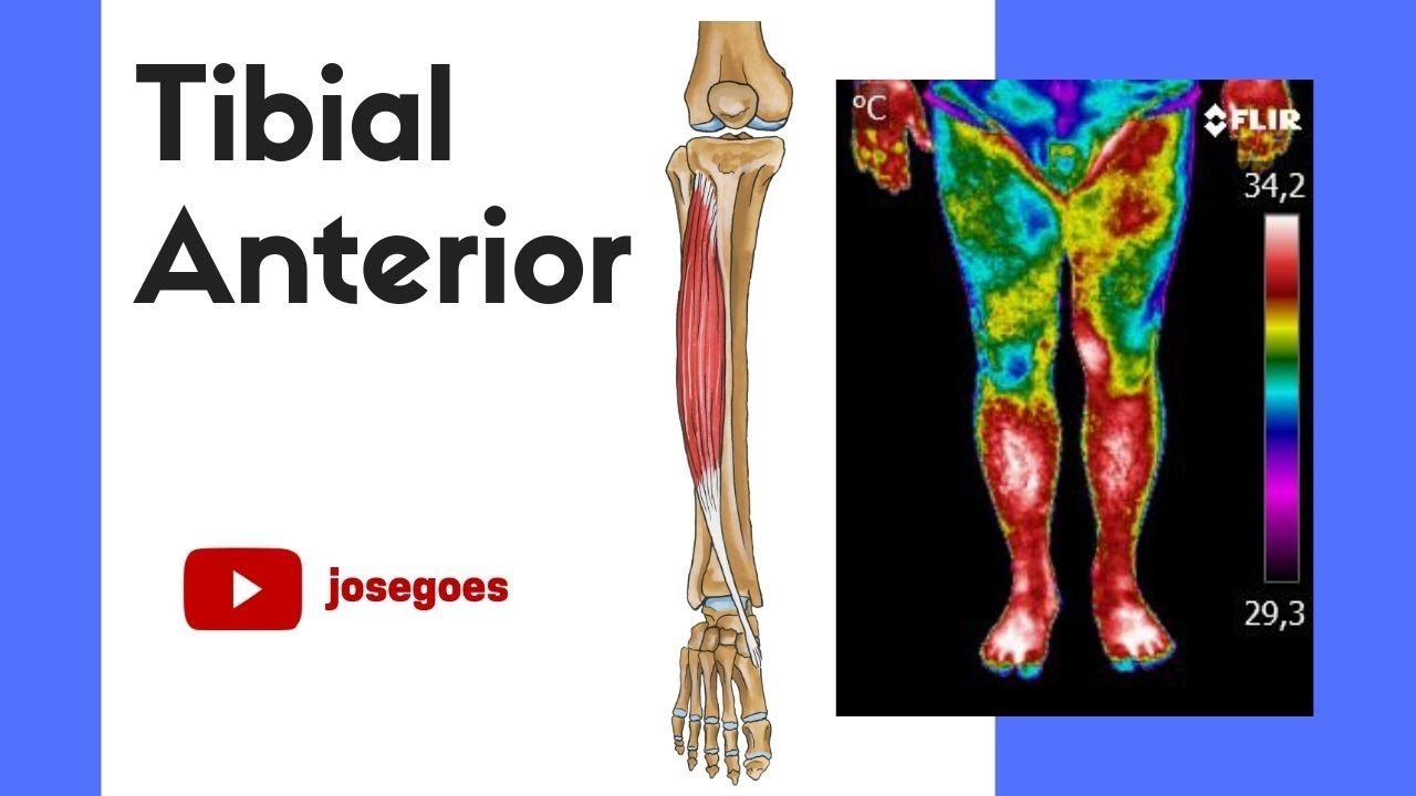 Músculo Tibial Anterior