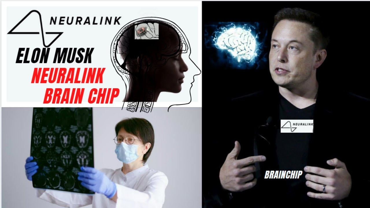 Neuralink Brain Chip | Elon Musk| Monkey MindPong