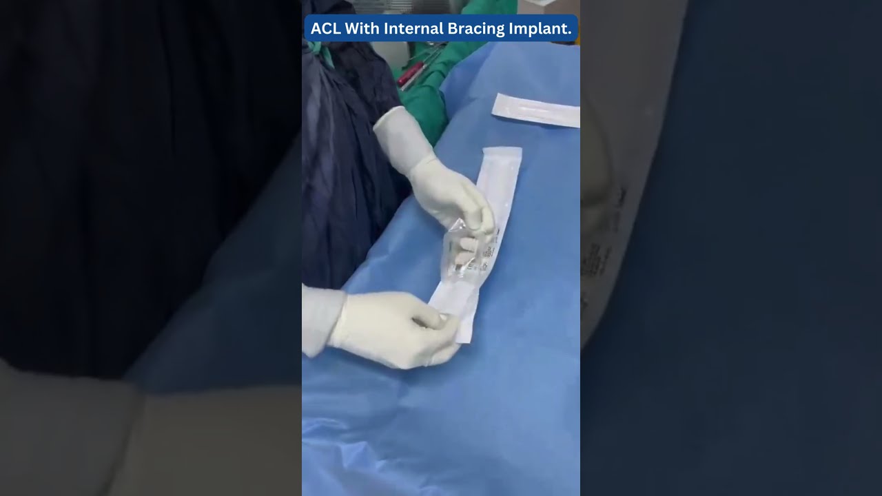 ACL Surgery with Internal Bracing: Advanced Techniques by Dr. Saurabh Giri