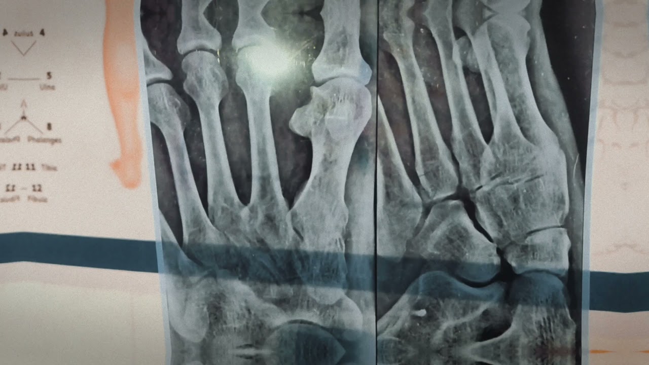 X RAY PRINTER LOW COST X RAY FILMS LOW COST LOW COST X RAY PRINTING SYSTEM PRINTER & FILMS LOW PRICE