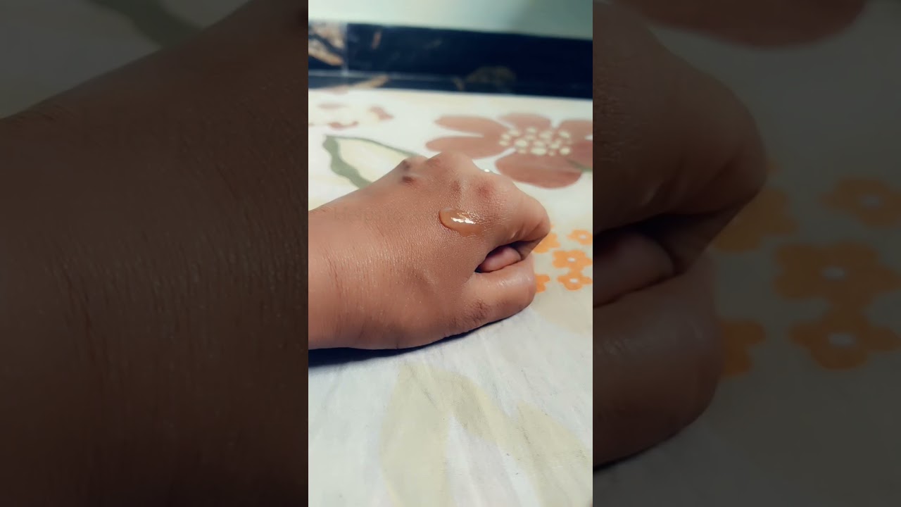 zitcare-s gel review # zitcare-s #shorts #youtubeshorts