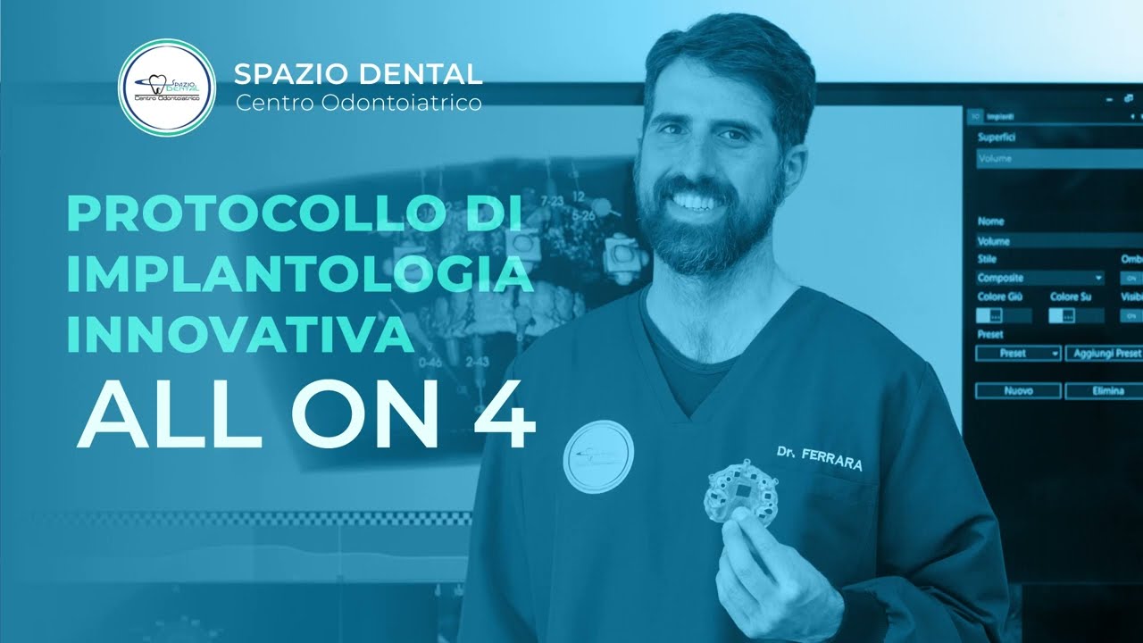 All on four: protesi dentale fissa con soli 4 impianti