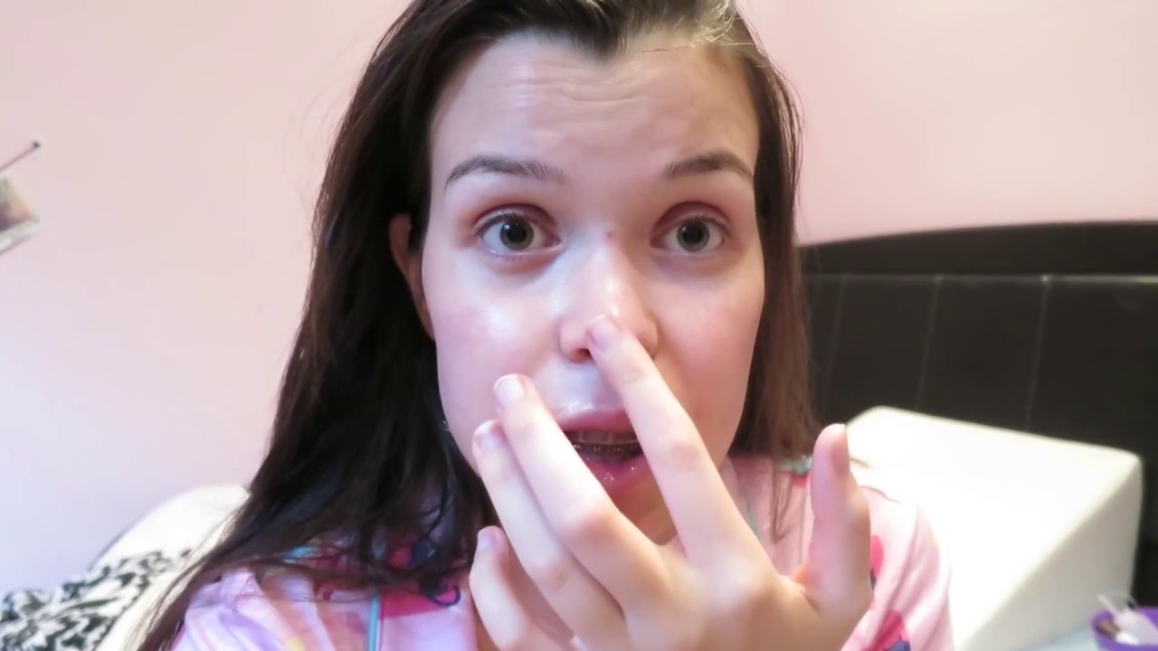 JAW SURGERY EXPERIENCE | Day 5