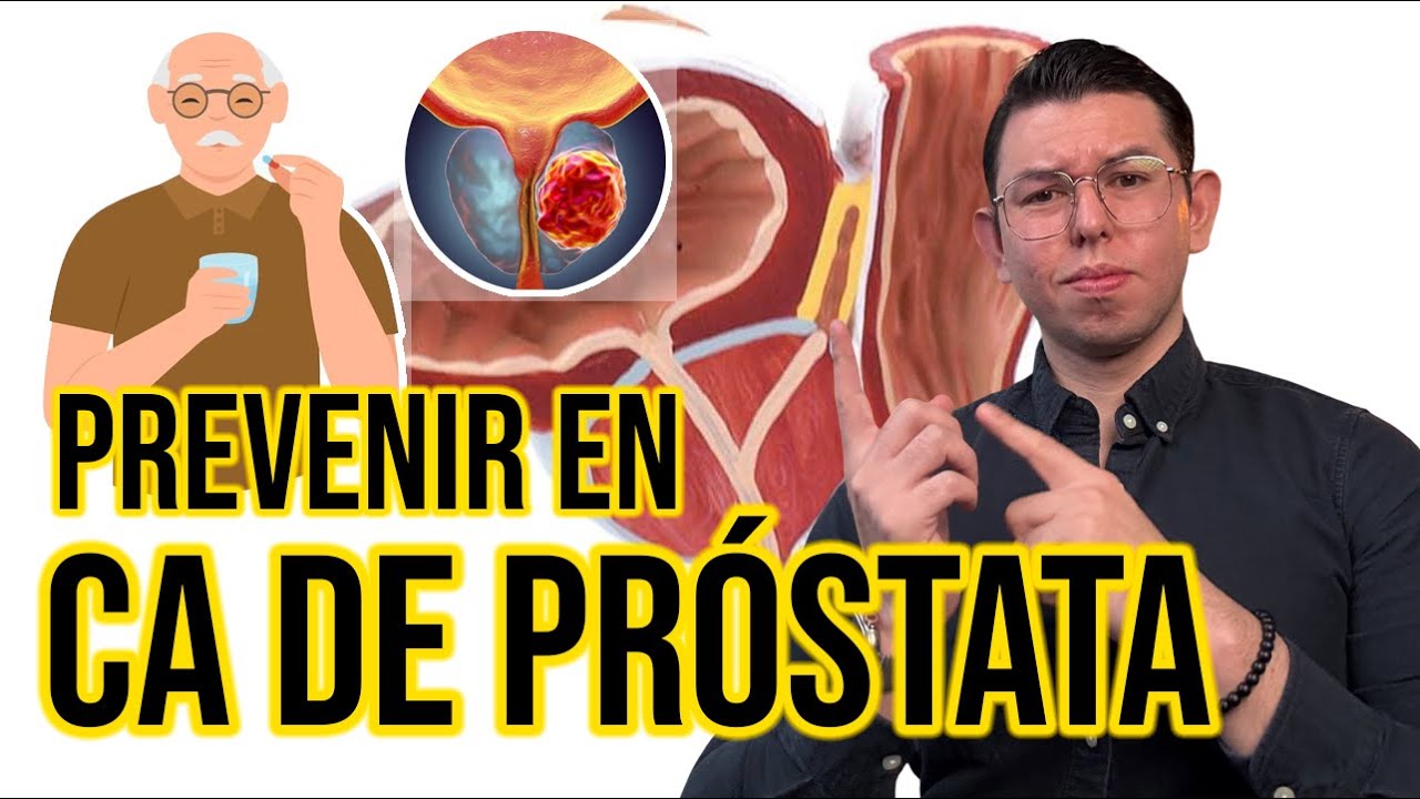 ¿Cómo EVITAR el CANCER de PRÓSTATA? | DrPoloGuerrero
