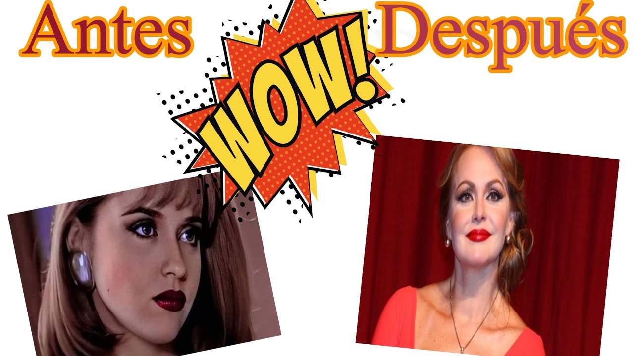 Antes y Después de actrices venezolanas Parte 2