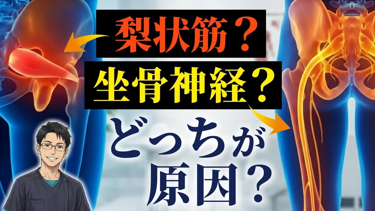 梨状筋症候群を良くできない人は必見！筋か？神経か？臨床で迷わない鑑別法