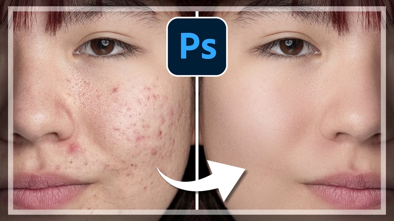Haut glätten, Flecken & Pickel entfernen | Besondere Retusche - Technik in Photoshop