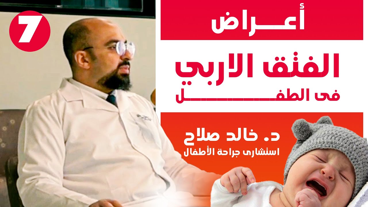 اعراض الفتق الاربي عند الاطفال | دكتور خالد صلاح #الفتق_الاربي #الفتق