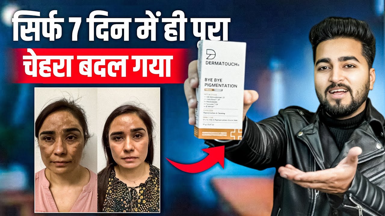 Dermatouch Bye Bye Pigmentation Cream Review | Dark Spots, Melasma & Uneven Skin Tone Results 😱
