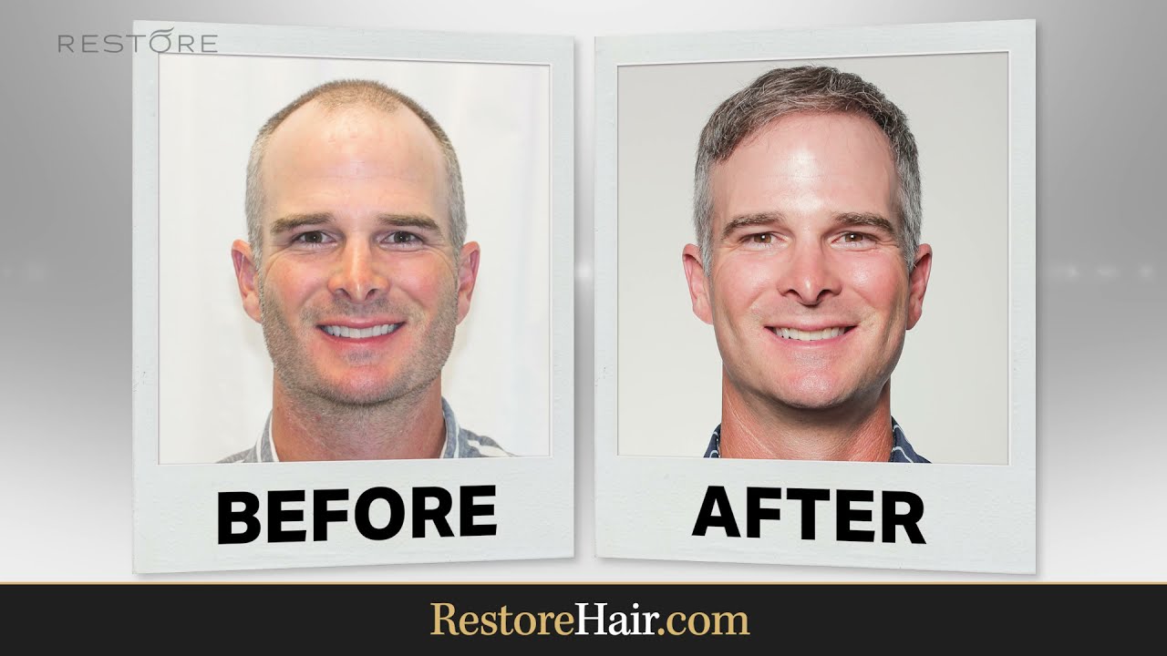 Kevin Streelman's Story | RESTORE Hair