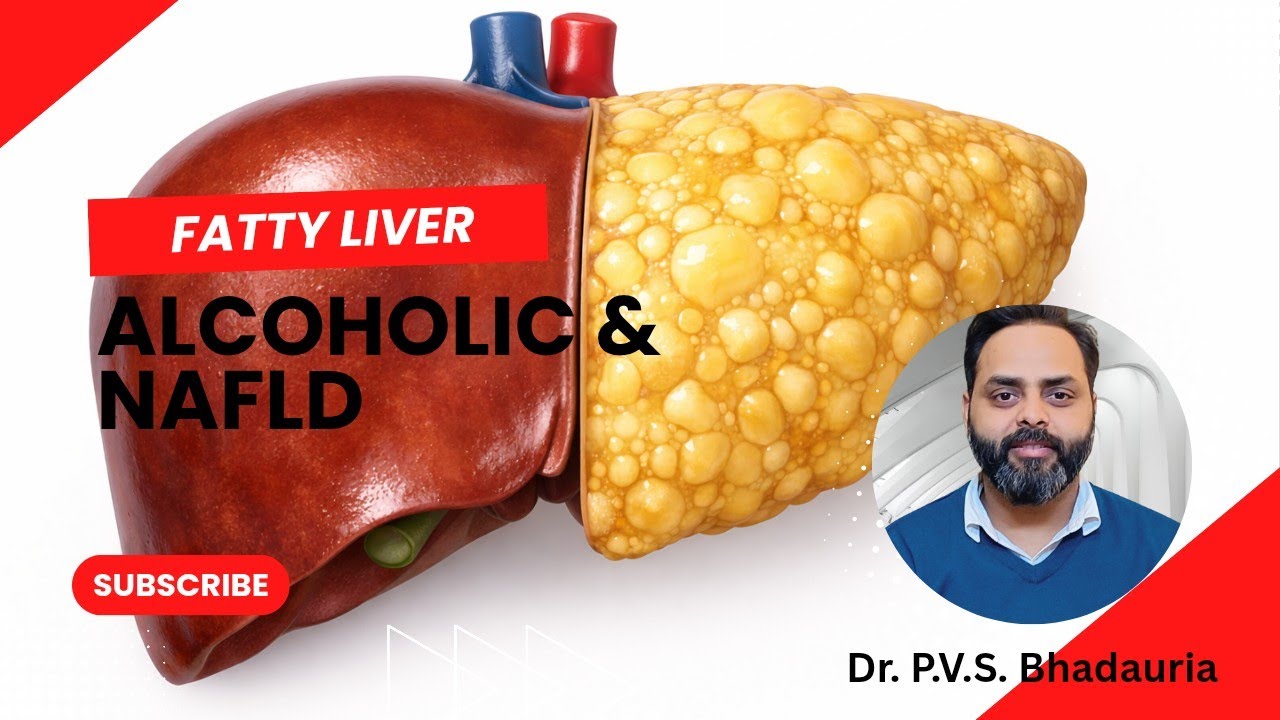 Fatty Liver Explained | Alcoholic & Non-Alcoholic (NAFLD) | Causes & Prevention