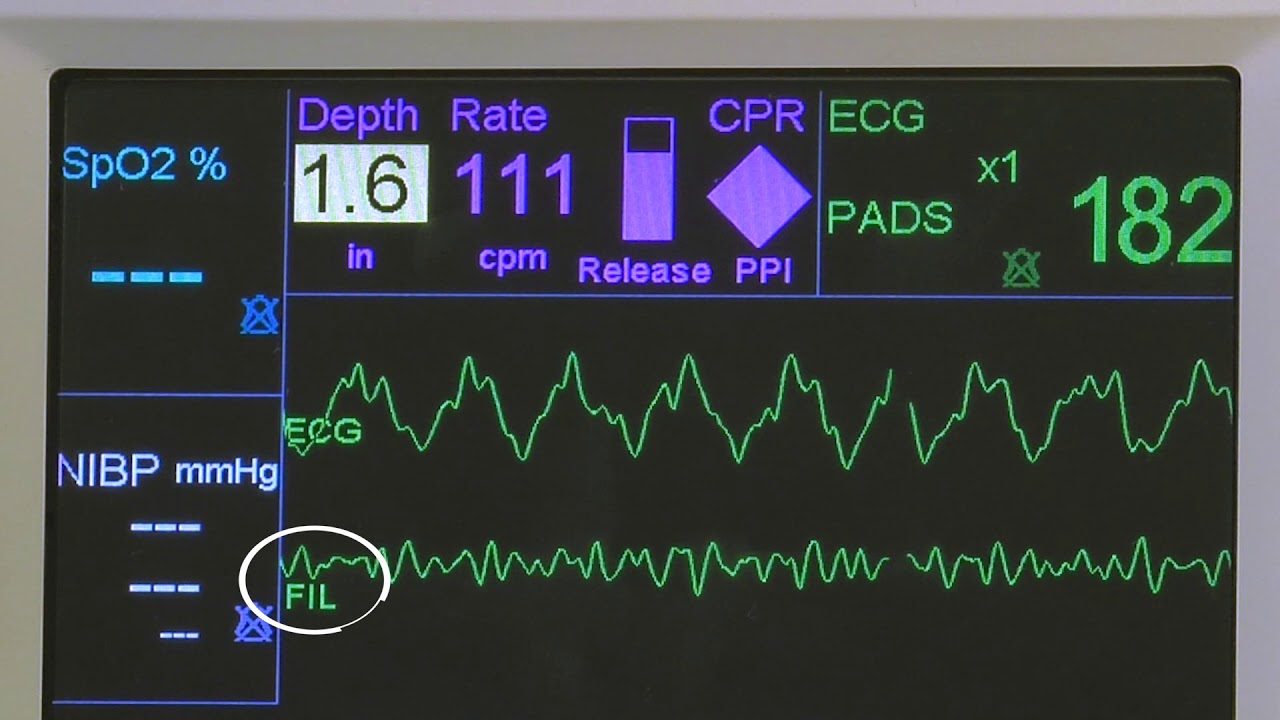 R Series Real CPR Help and See-Thru CPR - v14