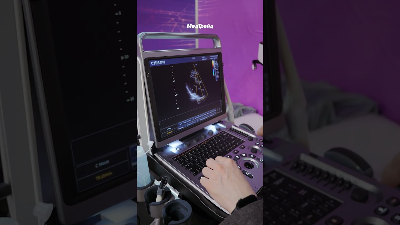 УЗИ аппарат Chison SonoBook 6 Кардио обследование #shorts  #узи #sonography #ultrasound #обучение
