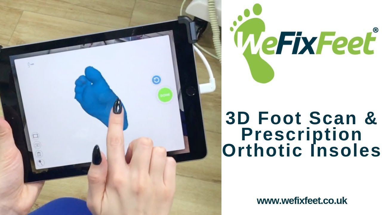 3D Foot Scanning and Manufacture of Bespoke Prescription Orthotic Insoles