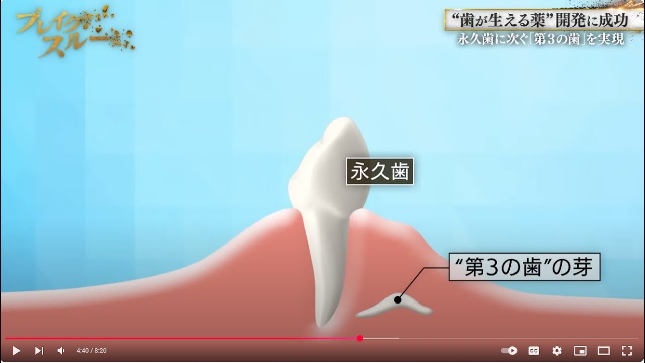 Dr Katsu Takahashi and Toregem Biopharma .. A Revolution in Tooth Regeneration