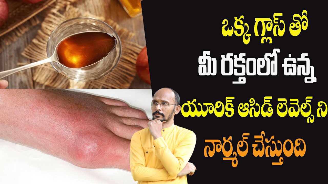 ఒక్కగ్లాస్ తో మీ రక్తంలో ఉన్న యూరిక్ ఆసిడ్ లెవెల్స్ ని నార్మల్ చేస్తుంది | Dr.MadhuBabuHealthTrends