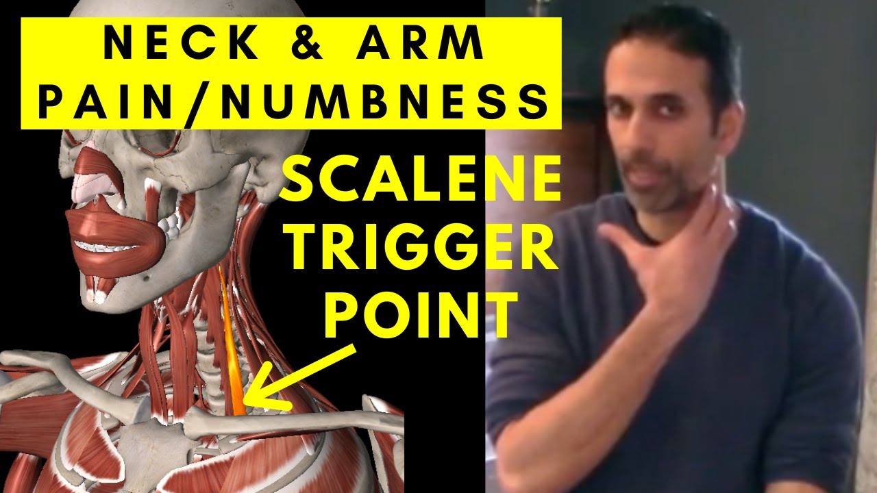NECK & ARM pain Relief: Scalene Muscle Trigger Points