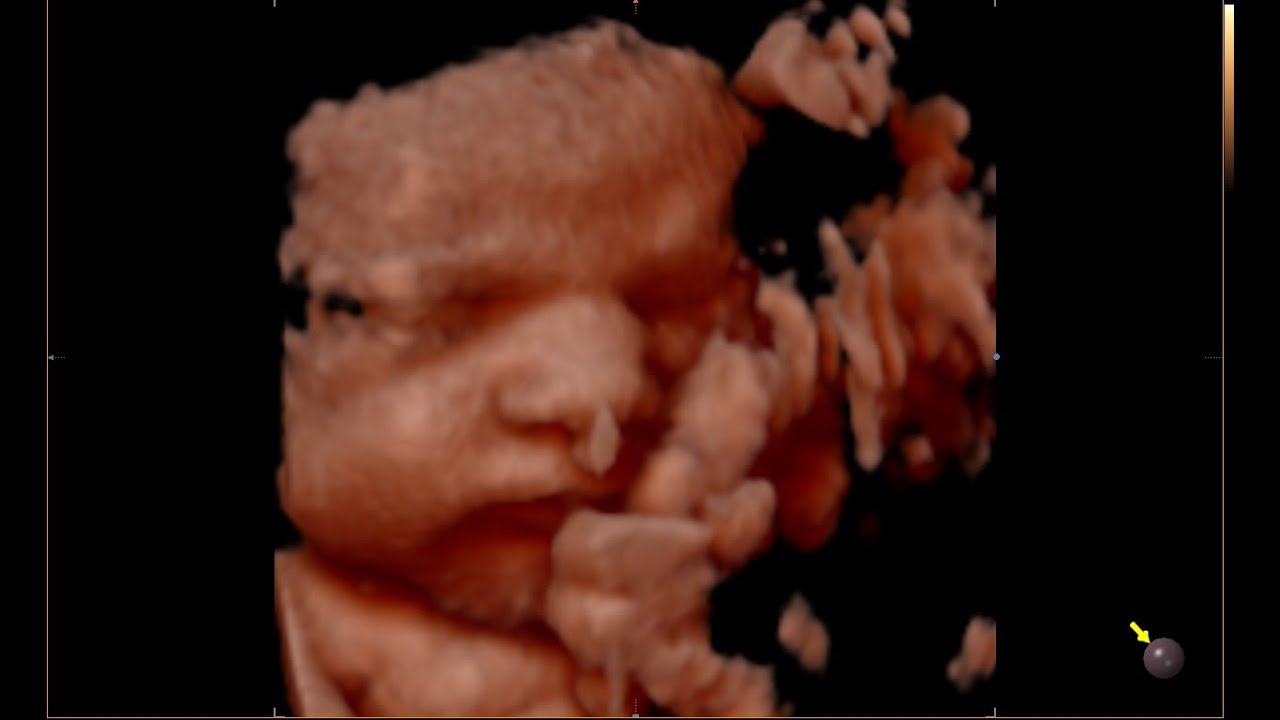 4D Ultrasound at 31 Weeks Pregnant!!!