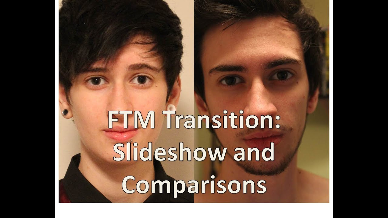 FTM transgender transition timeline: slideshow and comparisons (nearly 3 years on T)