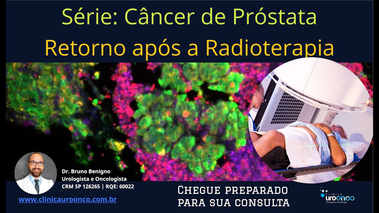 Próstata | Fiz Radioterapia e meu PSA Continua Subindo | A doença Voltou? Qual o Melhor Tratamento