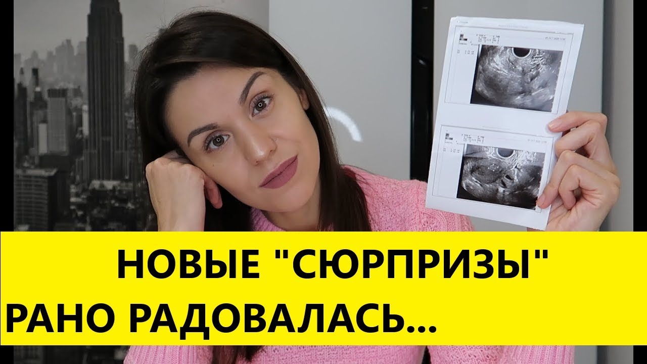 ПОЛИПЫ  В МАТКЕ I ПОВЫШЕНИЕ ОНКОМАРКЕРА CA 125 I ПОДГОТОВКА К  - ГИСТЕРОСКОПИИ И ЛАПАРОСКОПИИ