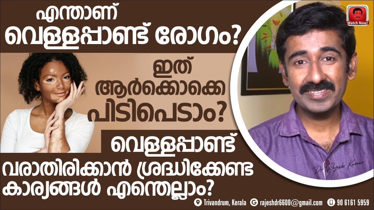 വെള്ളപ്പാണ്ട് രോഗം പിടിപെടുന്നത് എങ്ങനെ ? ഈ രോഗം പിടിപെടാതെ തടയാൻ ശ്രദ്ധിക്കേണ്ട കാര്യങ്ങൾ. അറിയുക