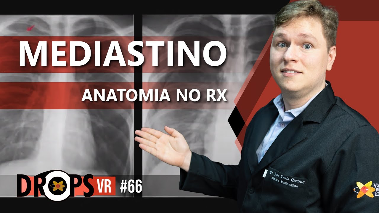 ANATOMIA DO MEDIASTINO NA RADIOGRAFIA E TOMOGRAFIA